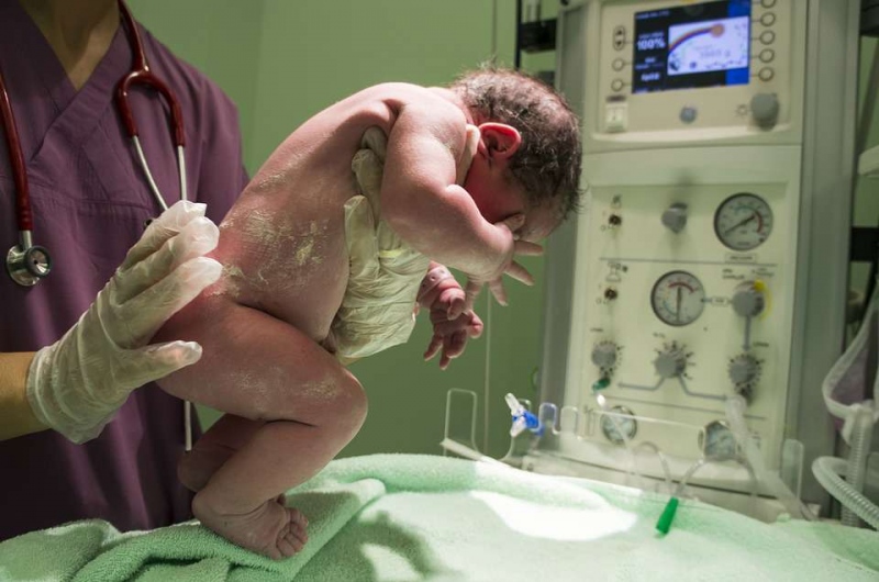 早产儿颅内出血的部位导致新生儿颅内出血的原因